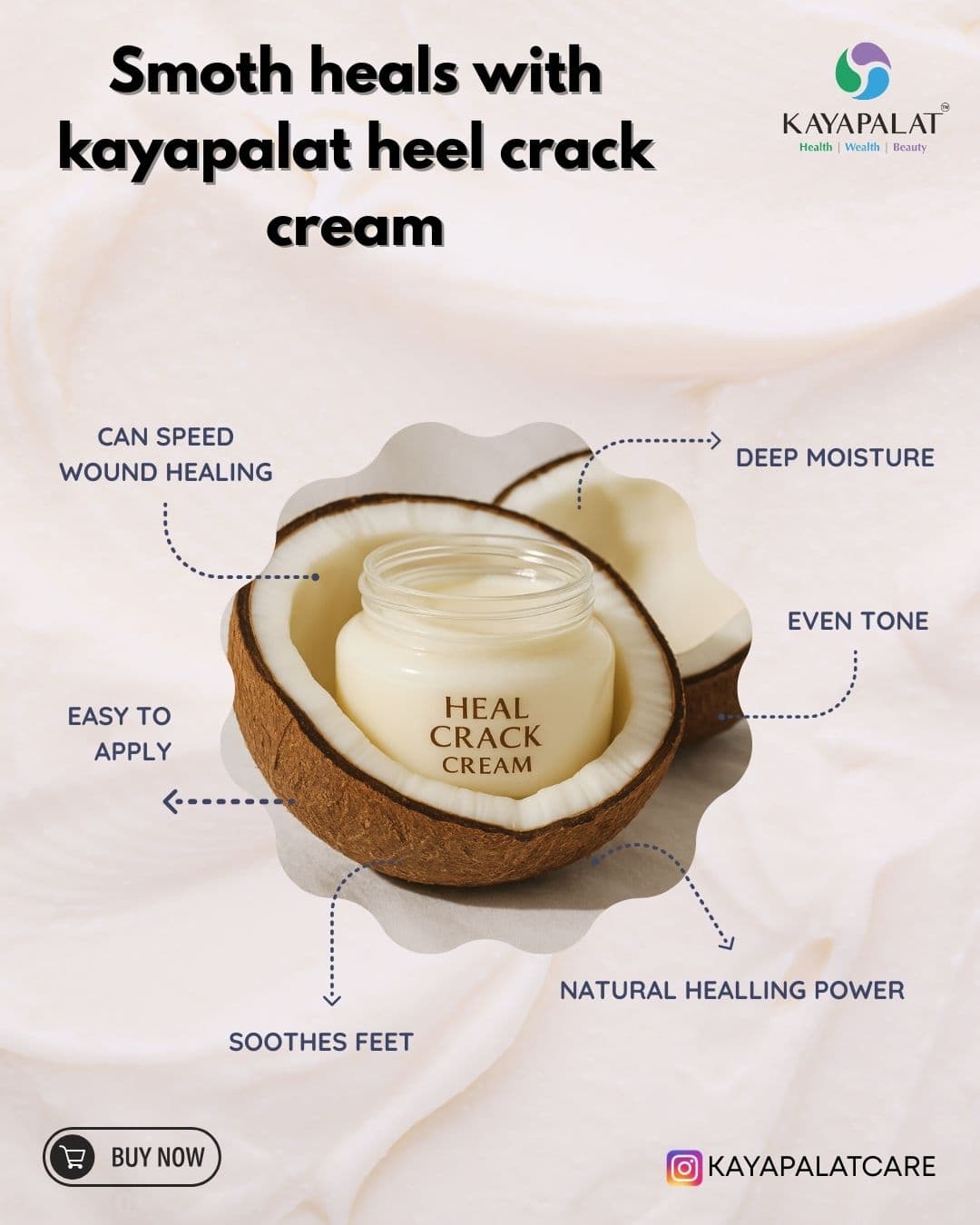 Heel Crack Cream | Ayurvedic Heel Repair Cream | Softer Heels| Repair Dry, Hard & Cracked Heels