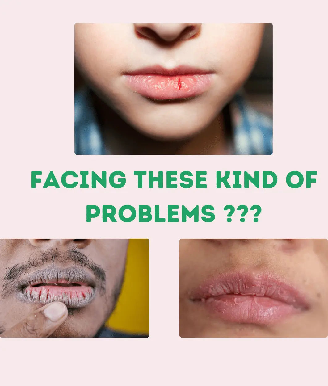 Kayapalat Mud-Lips | Lip Balm for Pigmented Lips Personal Care Kayapalat Care