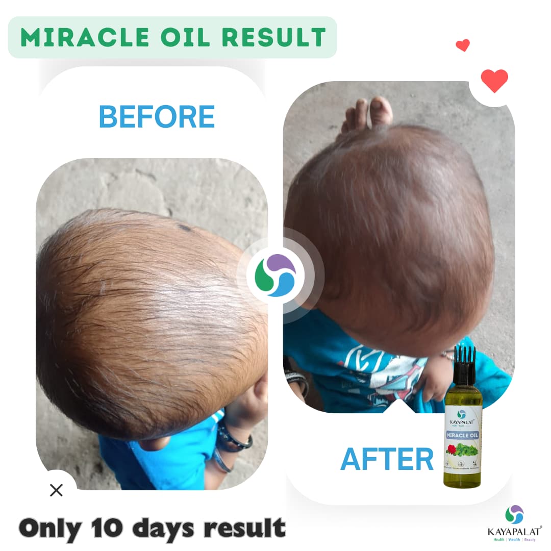 Miracle Hair Oil – Restore Damaged Hair, Strengthen Roots Naturally