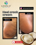 Heel Crack Cream | Ayurvedic Heel Repair Cream | Softer Heels| Repair Dry, Hard & Cracked Heels