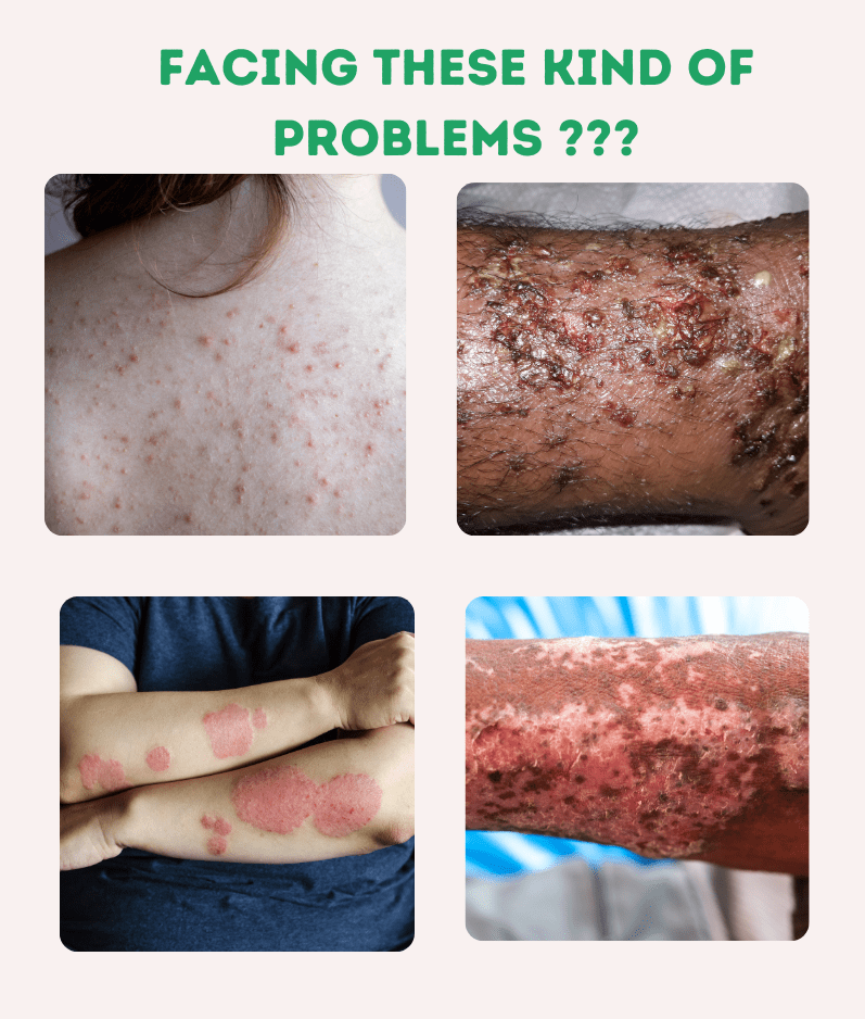 Kayapalat Mud Aushadhi – Ayurvedic Detoxifying Treatment for Glowing Skin thumbnail 4