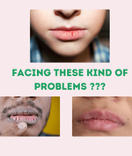 Kayapalat Mud-Lips | Lip Balm for Pigmented Lips Personal Care Kayapalat Care 