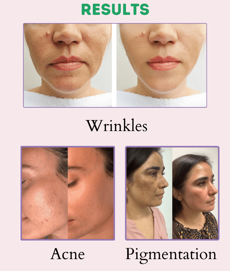 Multi-Purpose Cream – Your Ultimate Skincare Solution thumbnail 7